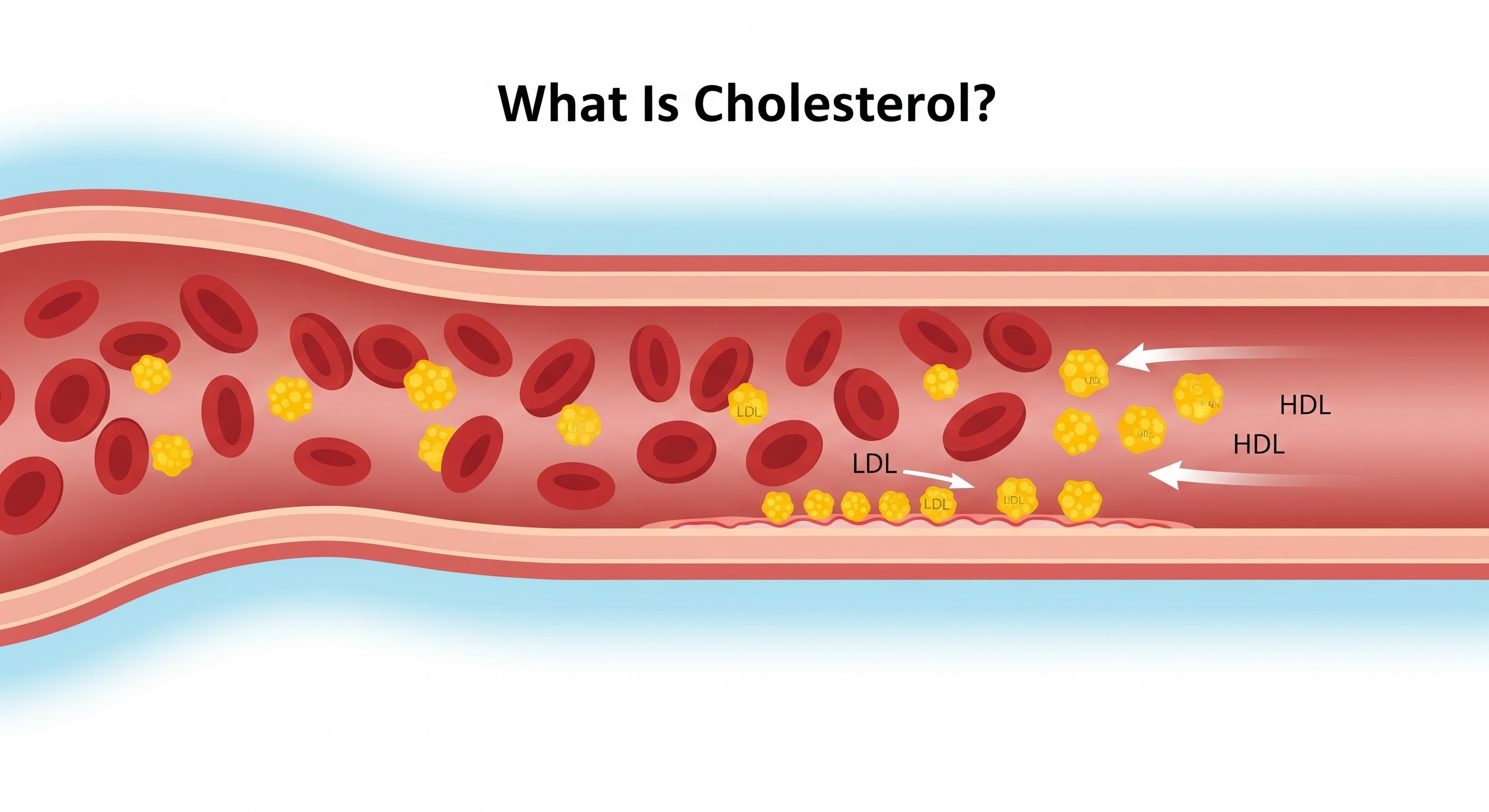 What Is Cholesterol